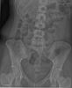 Abdomen_lig.jpg