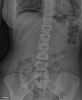 Abdomen_st.jpg