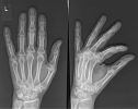 Hand.jpg