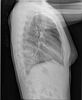 Thorax_p.jpg